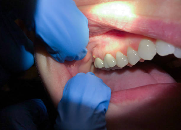 Best Knocked-Out Tooth Emergency  in Sunbury, PA
